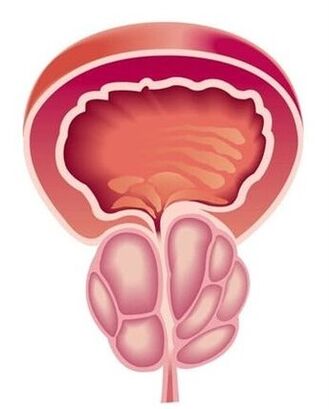 Gizonen prostatitisaren sintomak